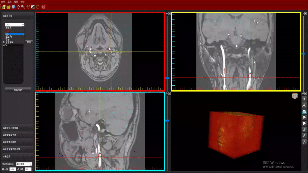CereScope™ MR-CPG