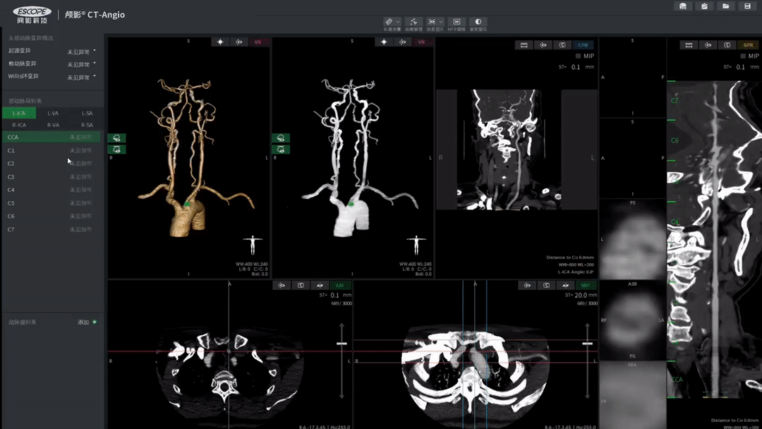 CereScope™ CT/MR-Angio