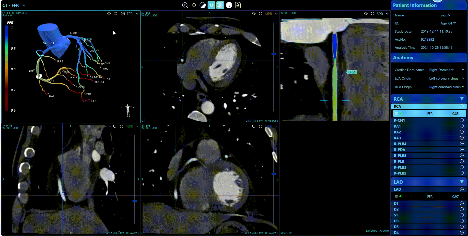 CT-Suite™  CT-FFR